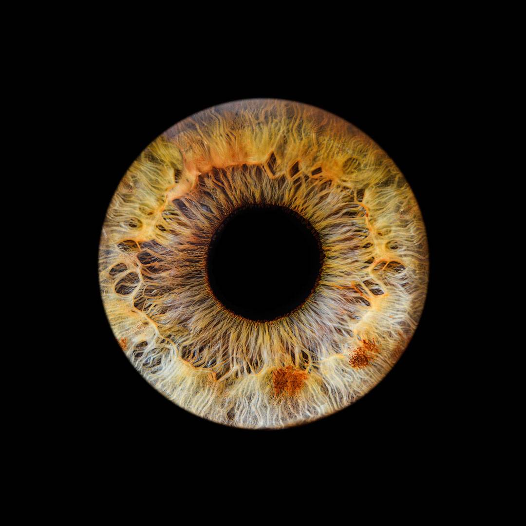 iris (3)